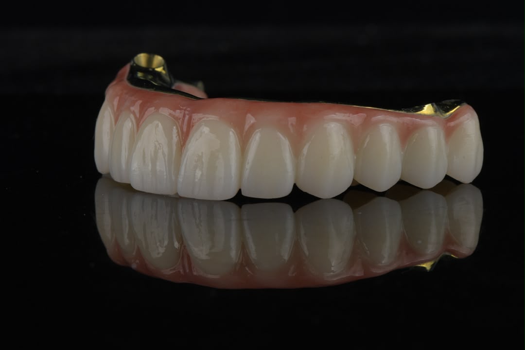 Full-arch zirconia restoration — angled view